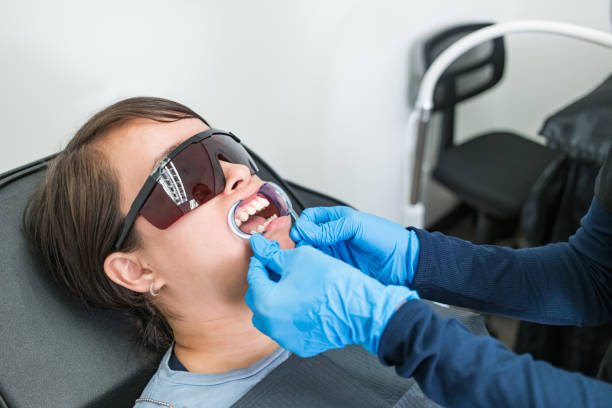 Best Emergency Dental Care for Broken or Chipped Teeth in Avon, CO